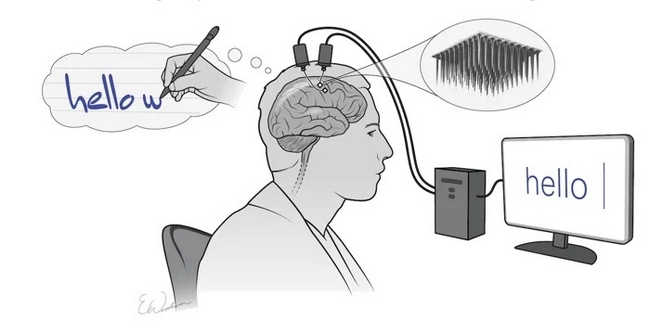 BrainImplant-2.jpg