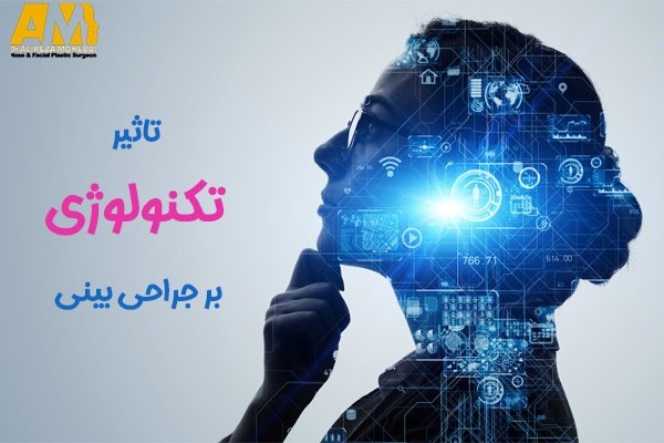 عمل رینوپلاستی