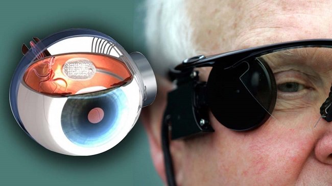 چشم بیونیک Science Eye بازیابی بینایی را به همراه دارد
