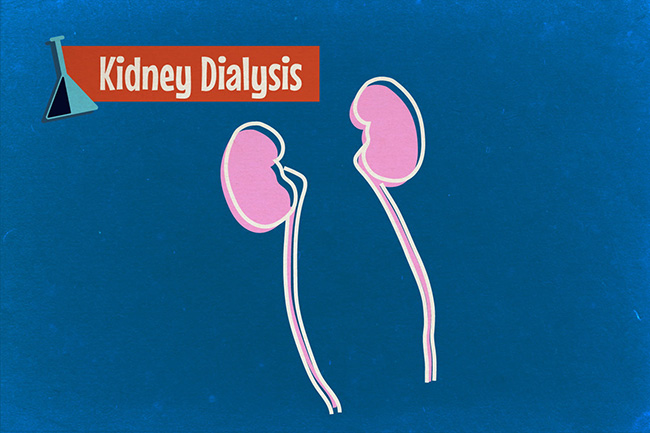 kidneydialysis.jpg