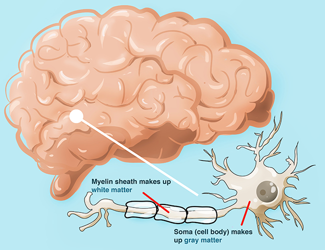 white_gray_matter.jpg